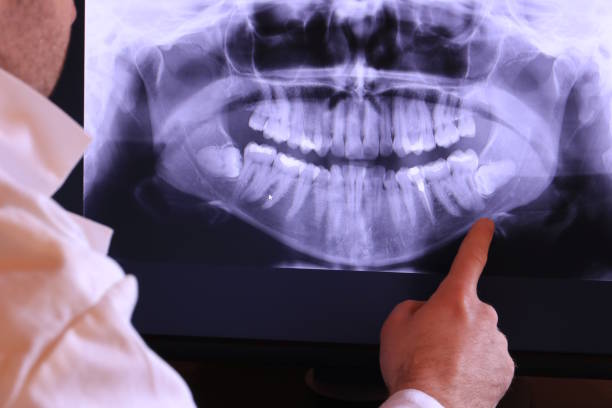 Best Broken or Chipped Tooth Repair in Lla Lla, WA